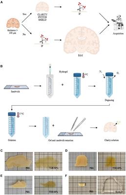 Comparison of Different Tissue Clearing Methods for Three-Dimensional Reconstruction of Human Brain Cellular Anatomy Using Advanced Imaging Techniques